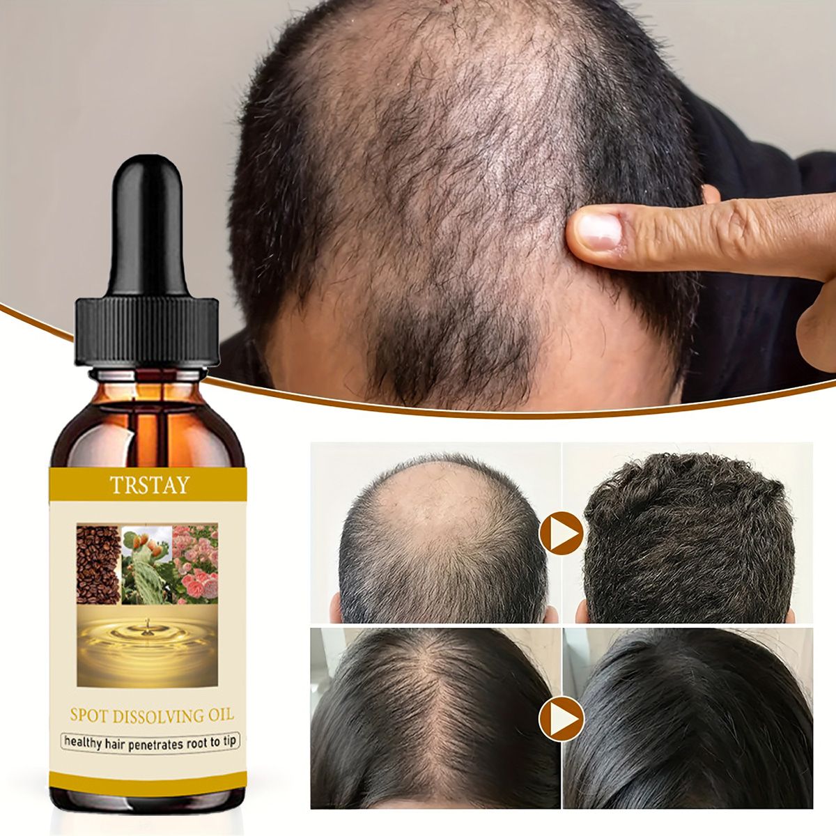 Beard Oil - 50ML sakal uzatma yağ Anti alopesi